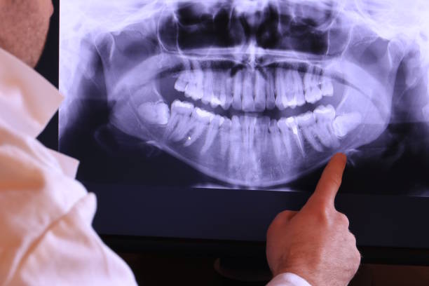 Best Dental Abscess Treatment in Towaoc, CO